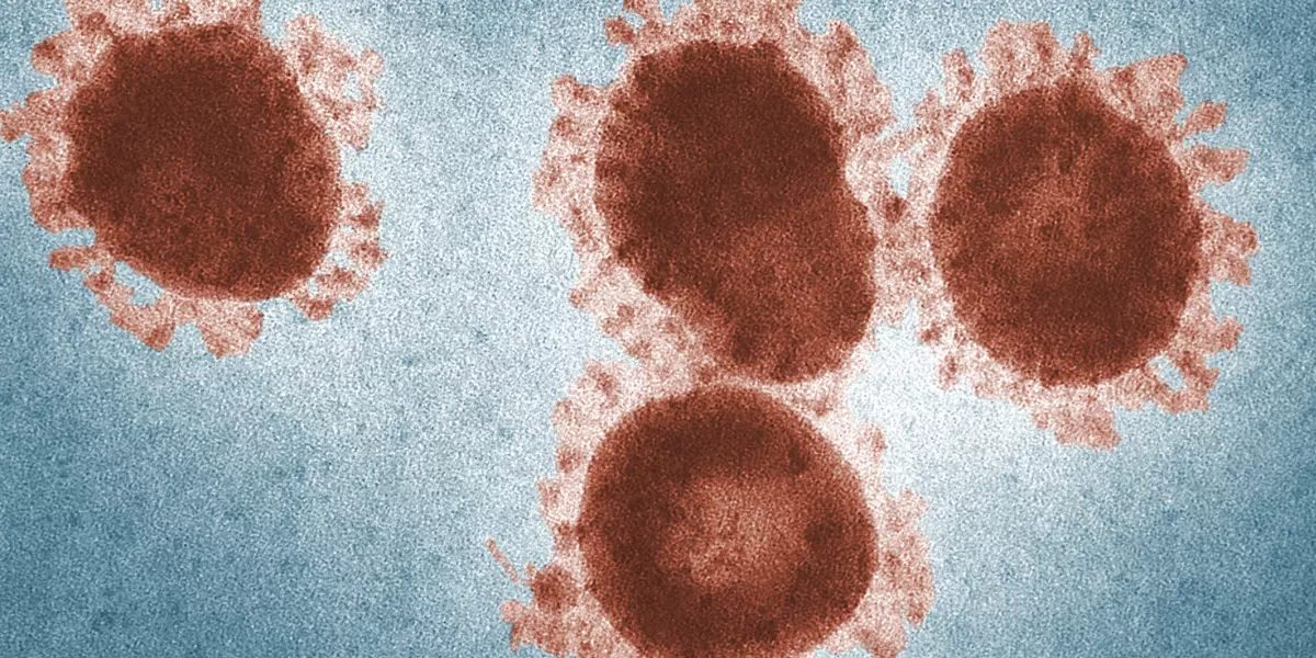 Hantavirus Varian Andes